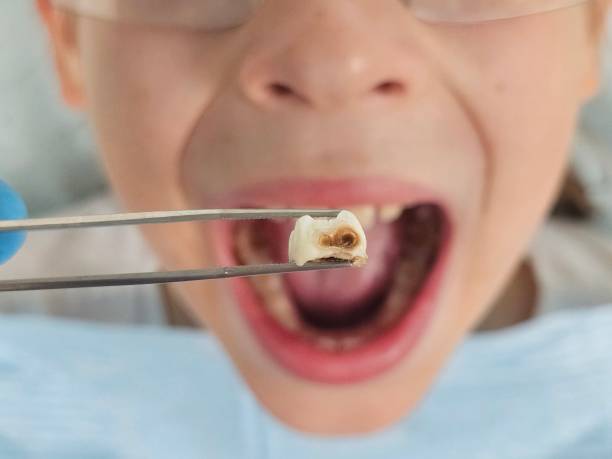 Best Broken or Chipped Tooth Repair in Seaville, NJ